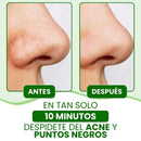 Lanbena removedor puntos negros + 60pcs